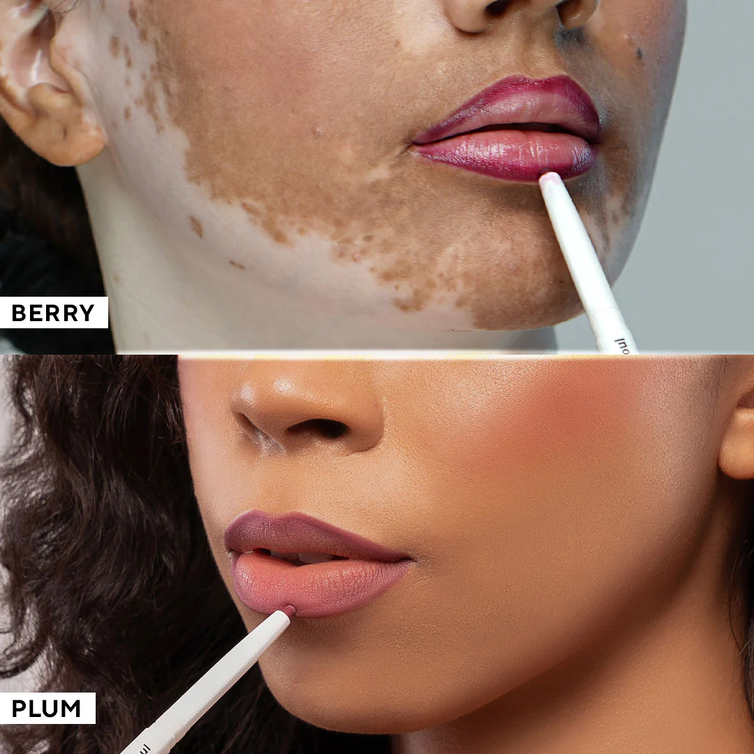 Product image 101